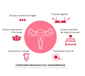 Endométriose