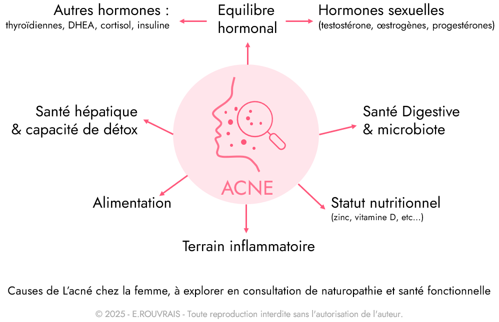 Causes de l’acné chez la femme