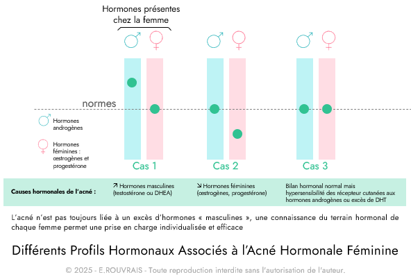Différents Profils Hormonaux Associés à l’Acné Hormonale Féminine